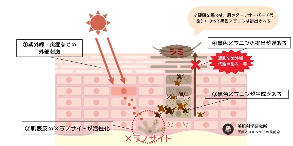シミができてしまう過程の図解