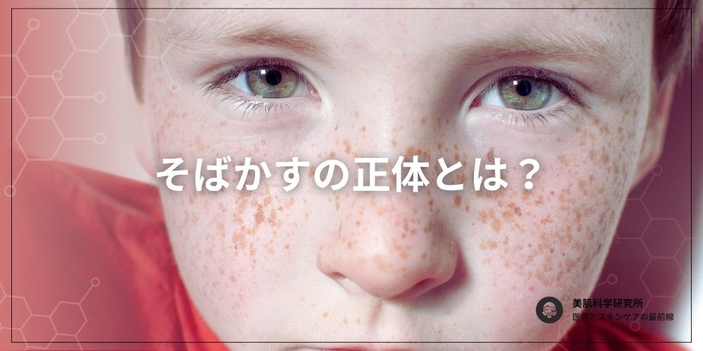 そばかすについて